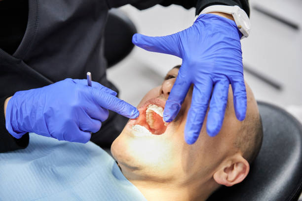 Best Emergency Treatment for Dental Infections or Abscesses in Mineral Springs, NC